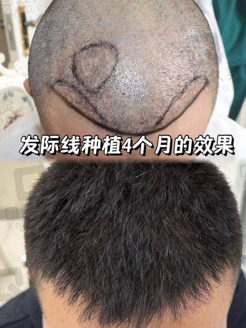 三、成都大麦与碧莲盛的口碑和患者实例评价