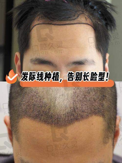 二、成都大麦与碧莲盛擅长项目的技术优势与医生水平