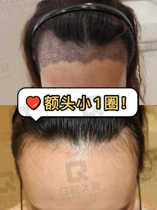 三、患者评价与反馈