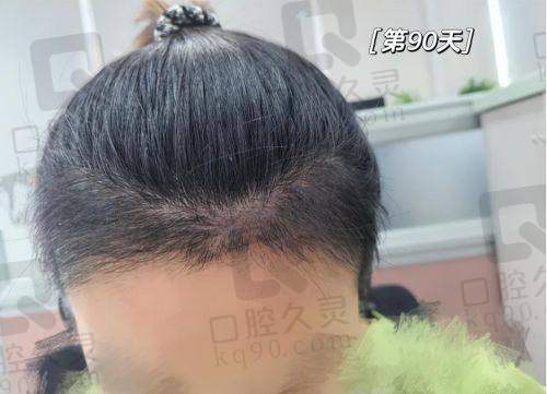 总结：成都大麦植发医院的特色与优势