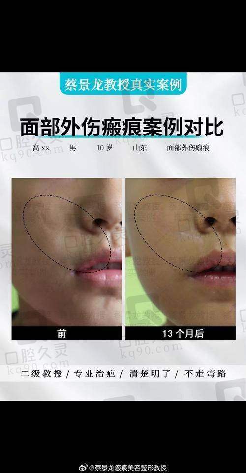 3. 用户口碑实例分享