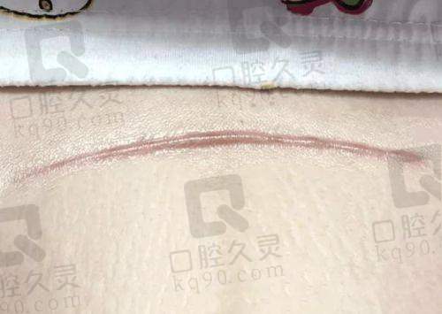 2. 在线弹窗预约
