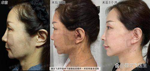 面诊前需要做哪些准备？
