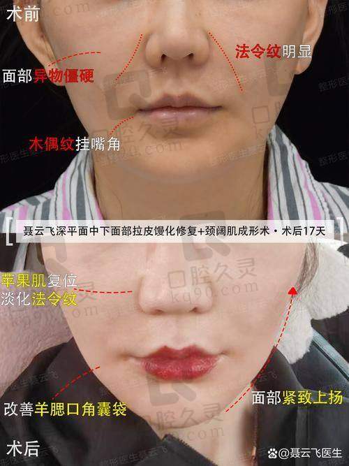袁强博士预约挂号有哪些途径？