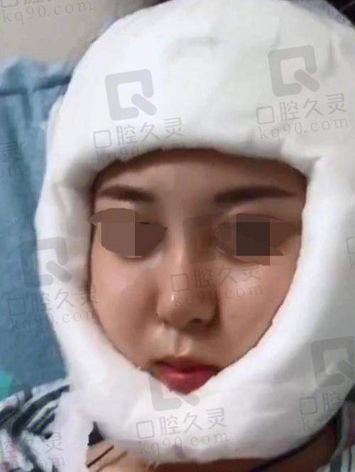 广州广大做下颌角怎么样？技术好费用低，医生强有保障，术后满意度超高！ 