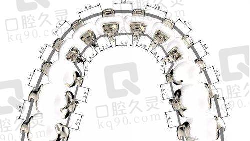 1. 广州穗华口腔