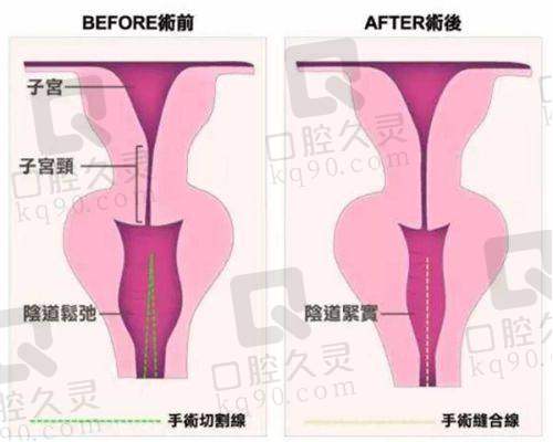 李瑞萱医生预约方式