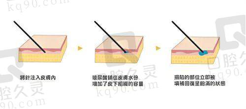 晋中兰积医疗美容诊所预约方式