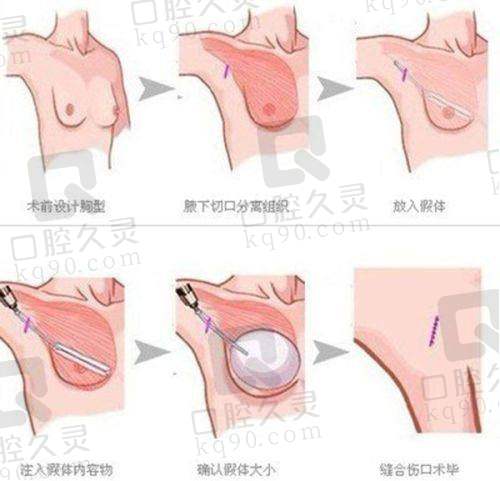 南昌佳美美容医院植发科预约方式