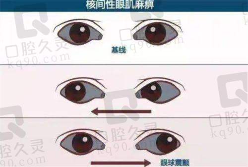 成都佰视佳眼科医院收费价目表之白内障手术费用怎样？