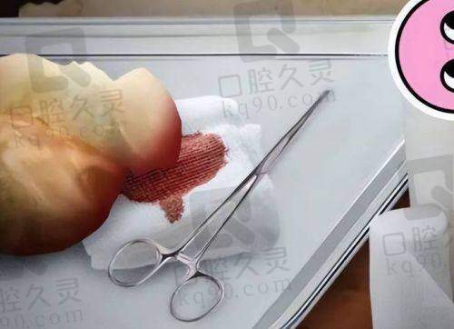 七、选择隆胸医院的注意事项