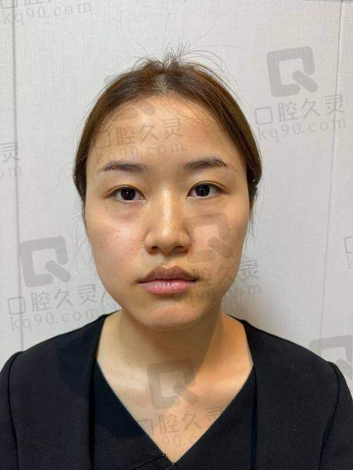 六、理性看待玻尿酸