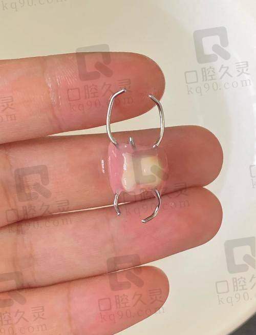 成都医大口腔医院的其他牙齿修复项目价格如何？