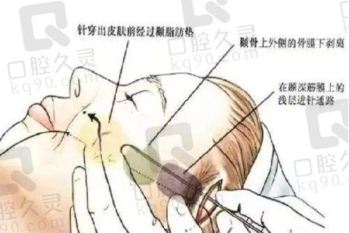 湛江韩美美容医院医生王新杰怎么样?资历技术口碑收费皆优,整形选他不亏