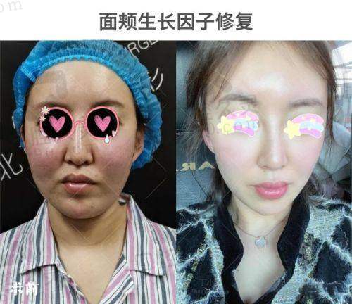长沙雅美医疗美容医院的特色项目有哪些？