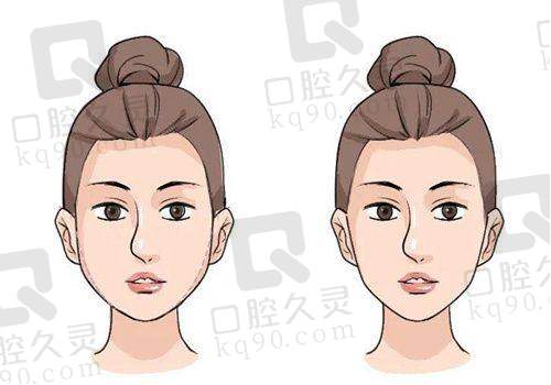 三、西安米兰柏羽医疗美容医院口碑分享，实例评价