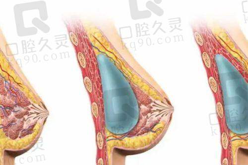 总结：长沙雅美，开启美丽新征程
