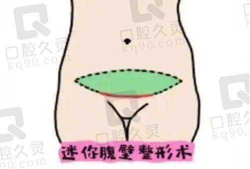 长沙雅美医疗美容医院的术后成效能维持多久？