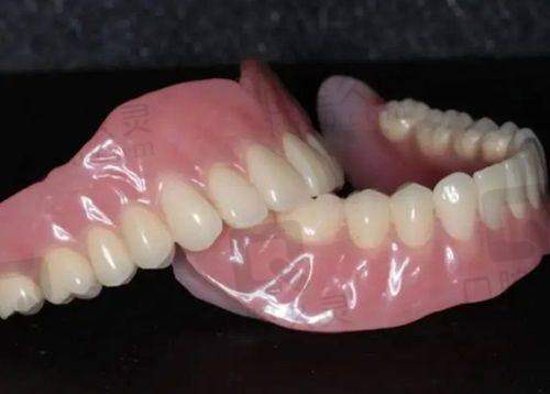 不同口腔项目在南通美奥口腔医院的收费有何差异？