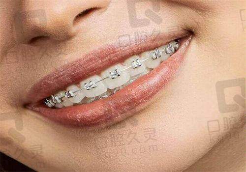 南通美奥口腔医院怎么样？