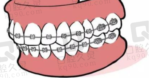 福州海狸家口腔：专注学生矫正，美牙贴心之选