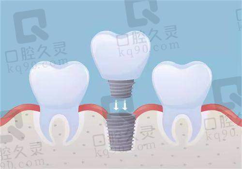 收费透明吗？价格表就在这儿