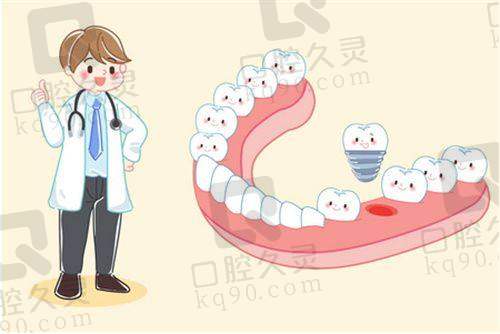 为什么选择宜宾喜牙口腔医院种植牙？