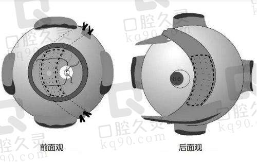 临汾洛基眼科医院收费标准