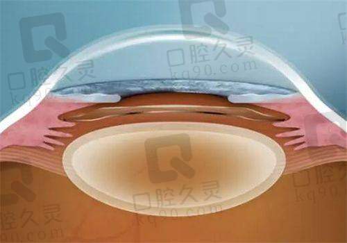 北京茗视光眼科医院周跃华医生患者评价与预约方式