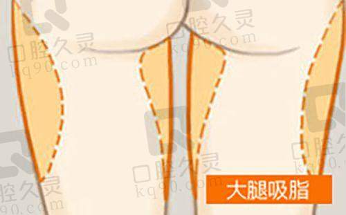 二、昆明韩辰整形医院擅长项目的技术优势与医生水平