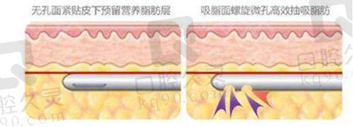 四、廊坊星范医疗美容门诊部特色项目