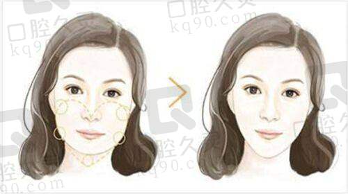 长沙雅美医疗美容医院的服务质量如何？
