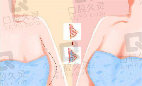 钟贵红：眼鼻胸整形多面手