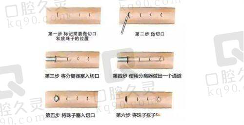 医生团队与技术实力：专精不错的美丽缔造者
