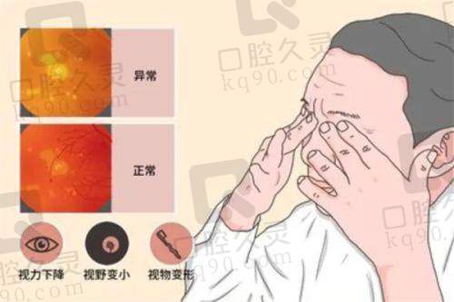 北京茗视光眼科医院周跃华医生学术成就与科研贡献