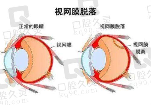 北京茗视光眼科医院周跃华医生简历含任职经历、擅长领域及社会职务等信息