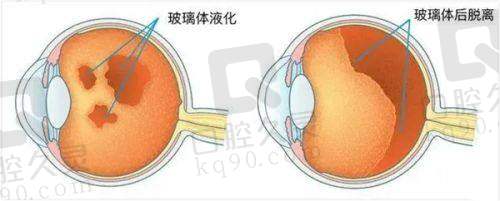 想知道临汾洛基眼科是不是定点医院？2025医保报销和收费标准揭秘！