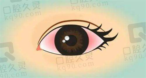 郑州视光眼科近视手术咋样?刘苏冰等医生靠谱,价格12100起