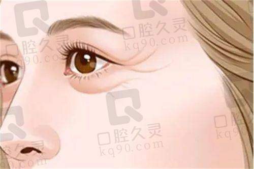 长沙雅美打除皱针体验分享，轻松淡化皱纹，肌肤重焕年轻光彩，过程超舒适 