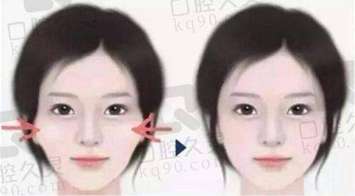 四、西安米兰柏羽医学美容医院详细地址及交通指南
