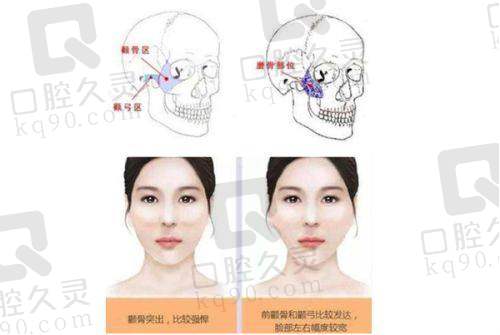 长沙雅美医疗美容整形医院吸脂与脂肪填充项目收费标准如何？