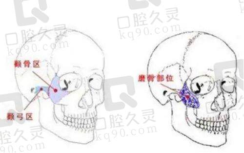 湛江韩美整形美容医院院长是谁？答案揭晓