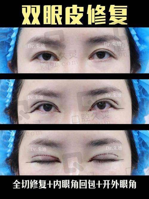 为什么越来越多求美者愿意排长队等待徐文云医生的修复手术？