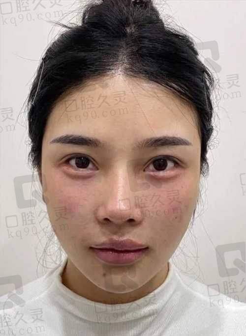 四、郑州王杨医生费用与预约信息