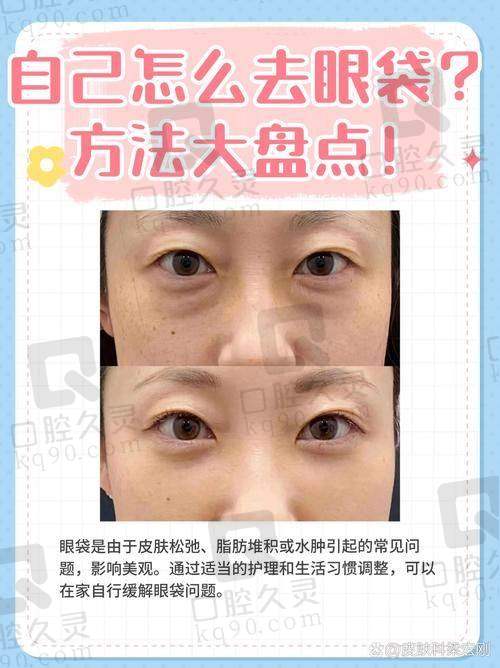 多样化的祛眼袋项目及合理价格