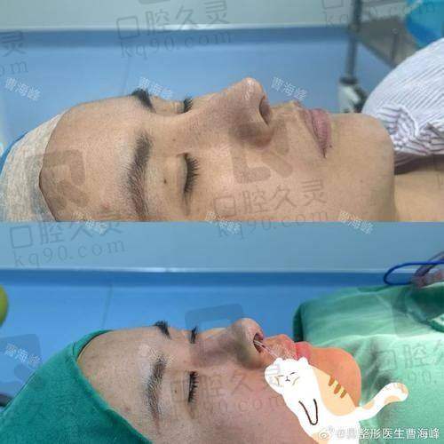 湛江韩美整形医院鼻整形服务流程