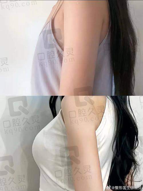 手术前的准备与紧张心情
