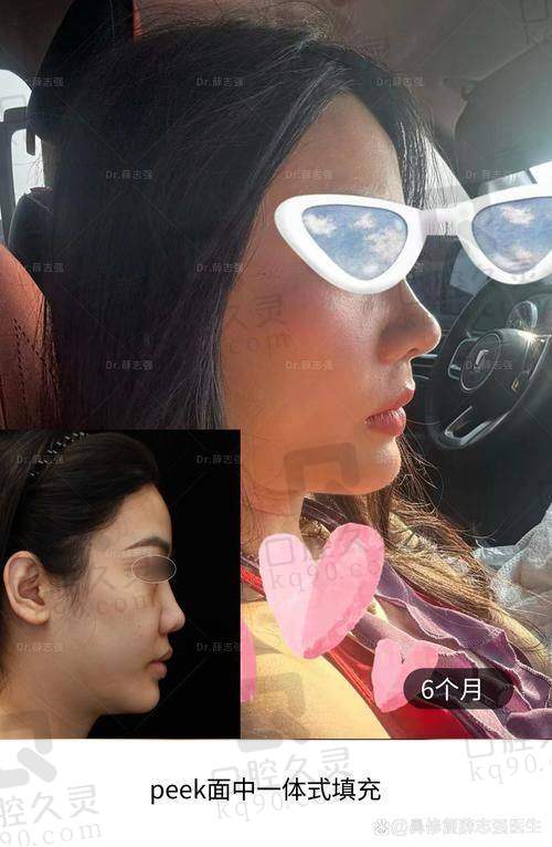 三、重庆松山医院何军 医生擅长项目