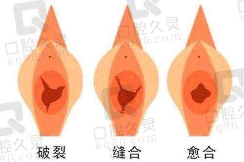 成都八大处私密整形怎么样？价格合理项目多，医生专业技术强口碑好 
