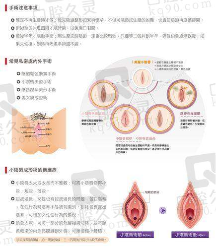 成都八大处整形医院价格：合理实惠不坑人